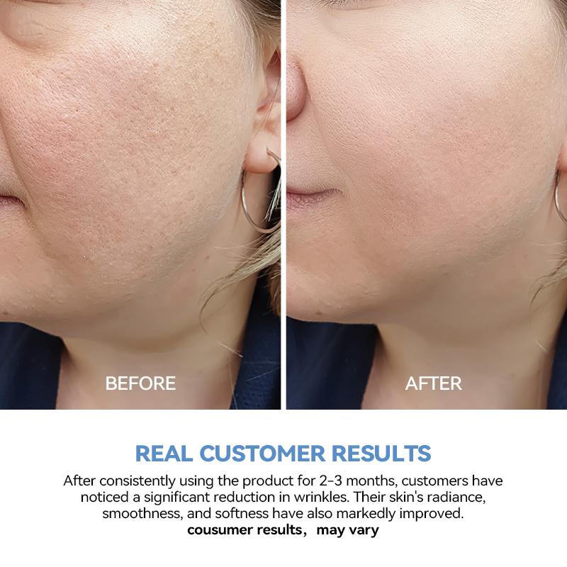 Hyaluronic Acid Ultra-Hydrating Serum